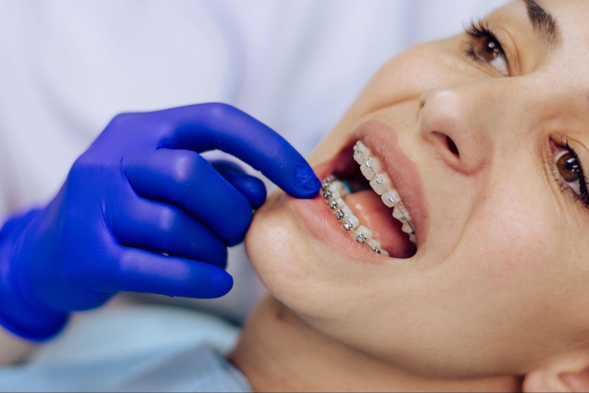 Is Orthodontic Treatment Painful?